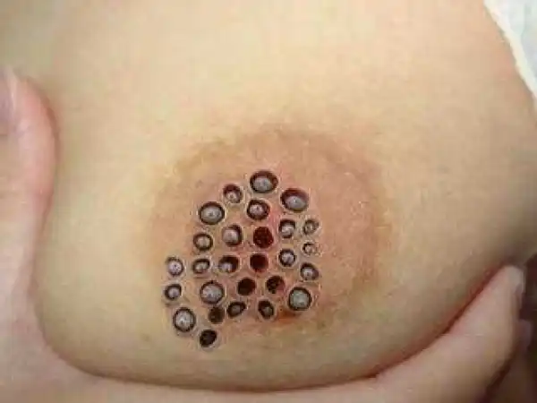 See Why You Must Wash Your New Undies Before Wearing Them [Photo Viewer’s Discretion]